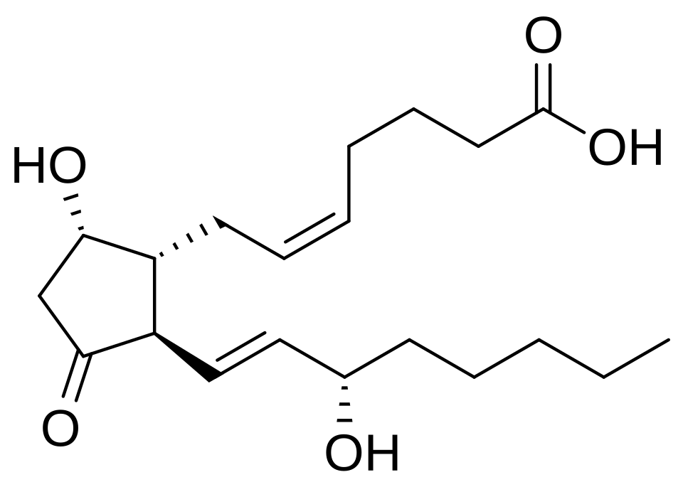 Setipiprant: The PGD2 Antagonist That Almost Was