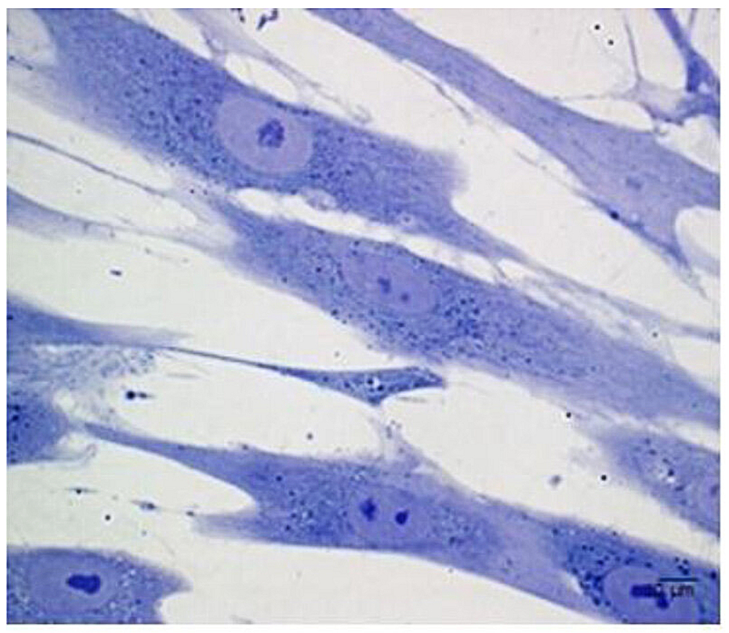 Light microscopy image represents periodontal ligament stem cells culture stained with toluidine blue (with permission from [20]). Reprinted from European Cells and Materials, 32, Diomede F, Zini N, Gatta V, Human periodontal ligament stem 