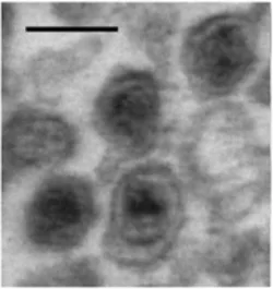 Microvesicles in the broader extracellular-vesicle family.