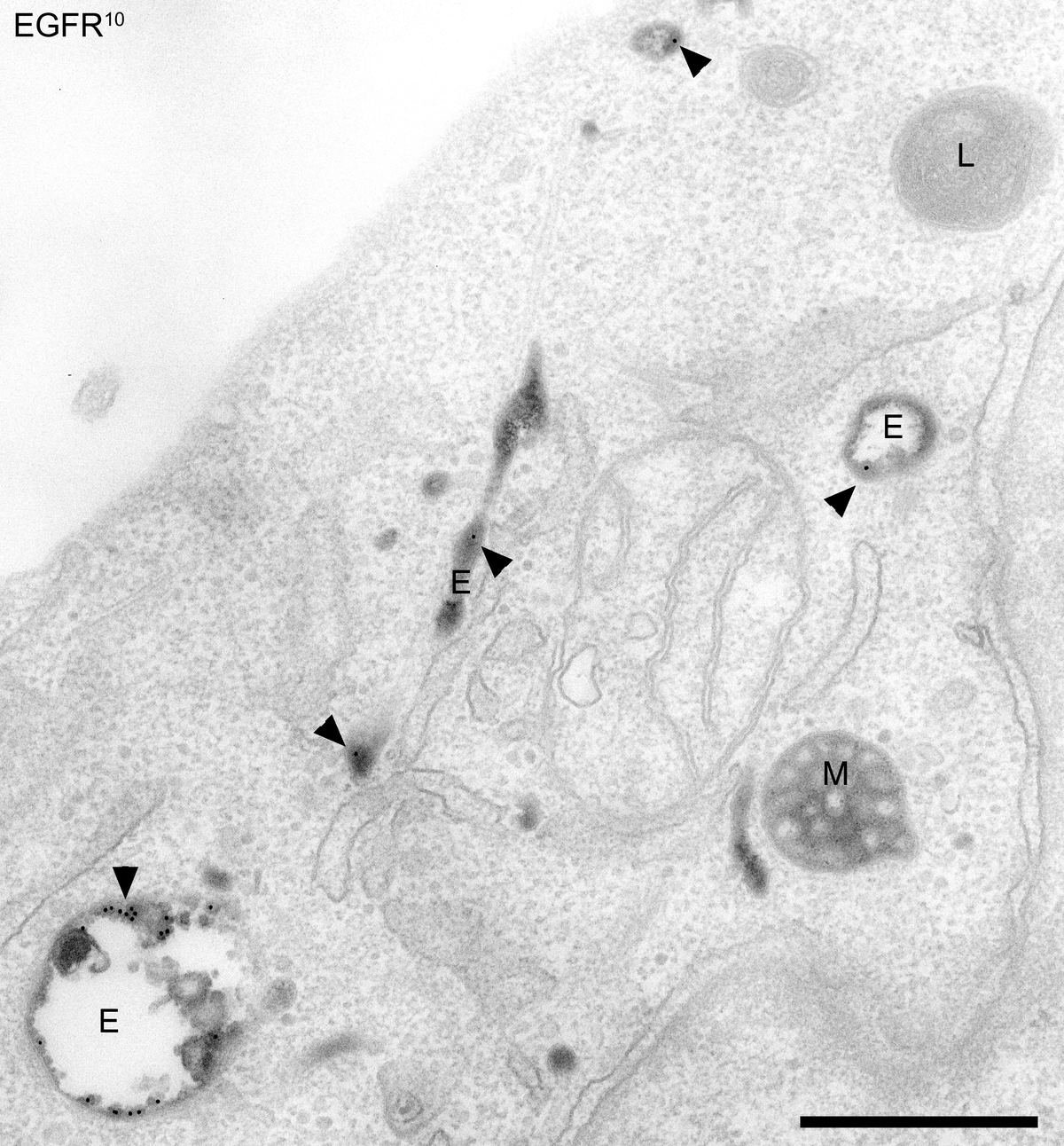 Quantitative hair shaft diameter and terminal hair count tracking across clinical trial timelines.