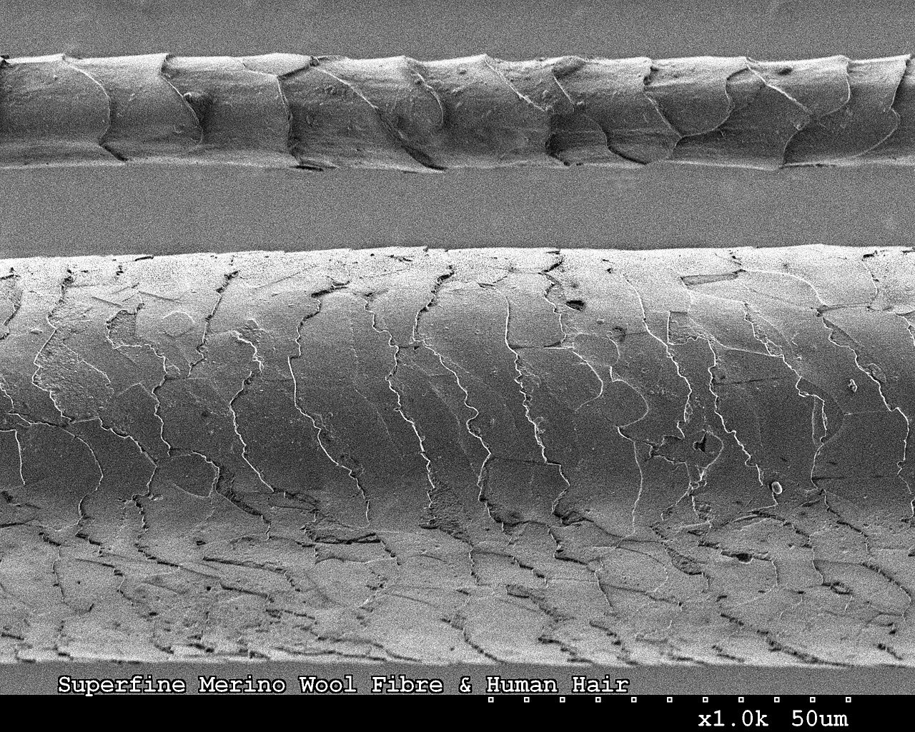 Quantitative hair shaft diameter and terminal hair count tracking across clinical trial timelines.