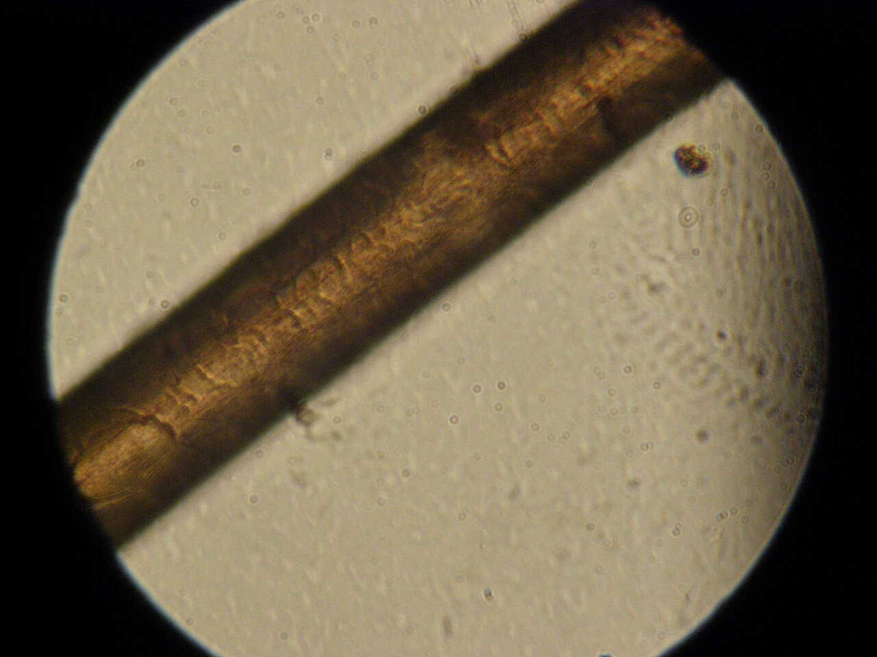 Dermatoscopic high-magnification trichoscopy comparing baseline follicular architecture to treated scalp.