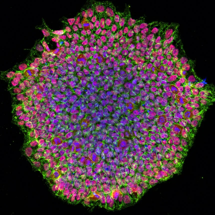 Induced pluripotent stem cells, the starting material for follicle regeneration.