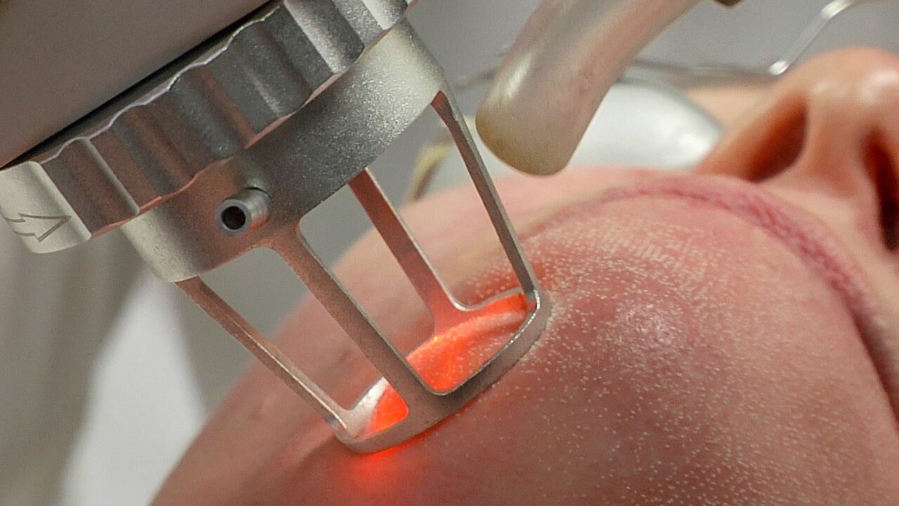 Hair Follicle Cloning: Stemson Therapeutics and the Quest for a Cure