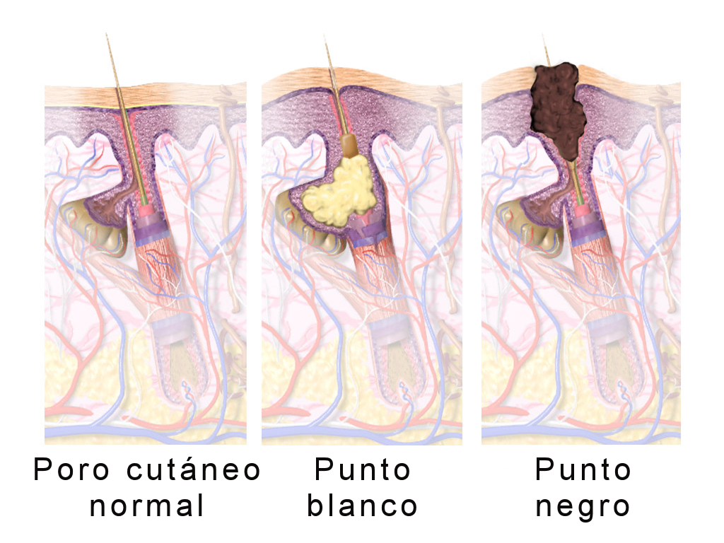 Scientists Have Mapped the Mechanism Behind Chronic Telogen Effluvium, IL-33 Is the Key