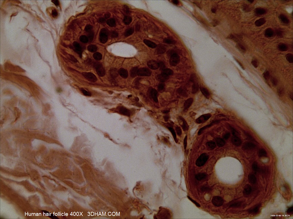 Microscopic image of human hair follicle