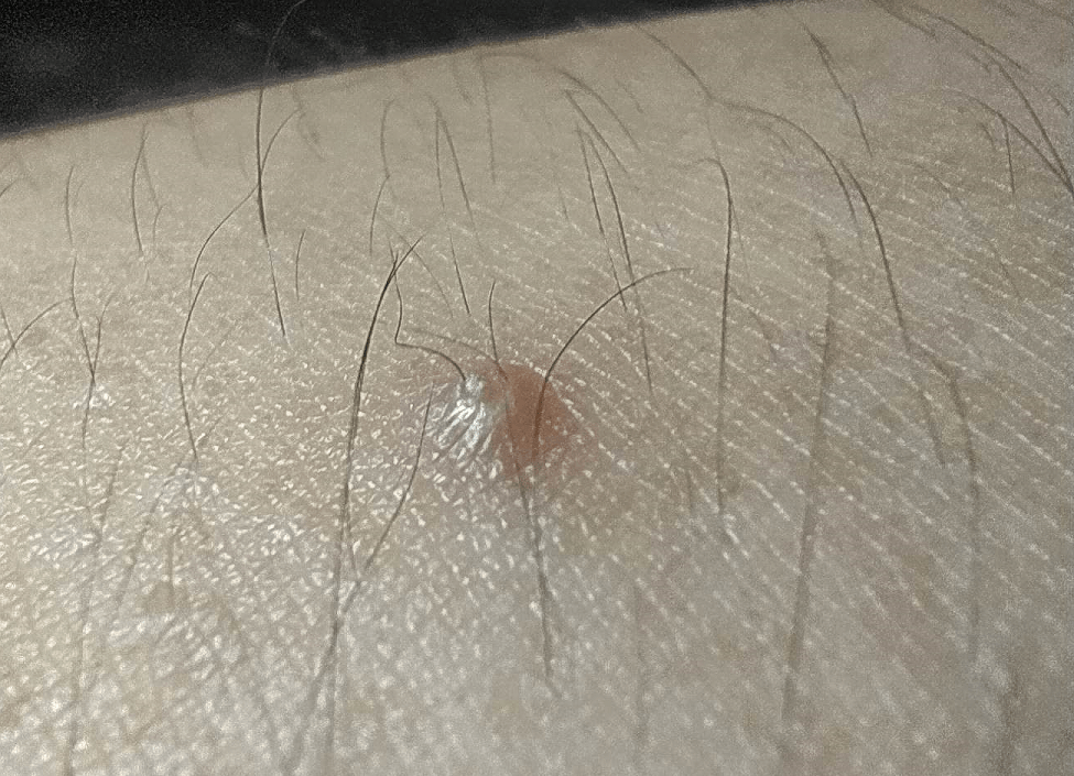 Hair strands are made up of different components as listed above and contain a variety of distinguishable patterns with the pigment, medulla, and scale structure that allow forensic scientists to use them as evidence in solving crimes.