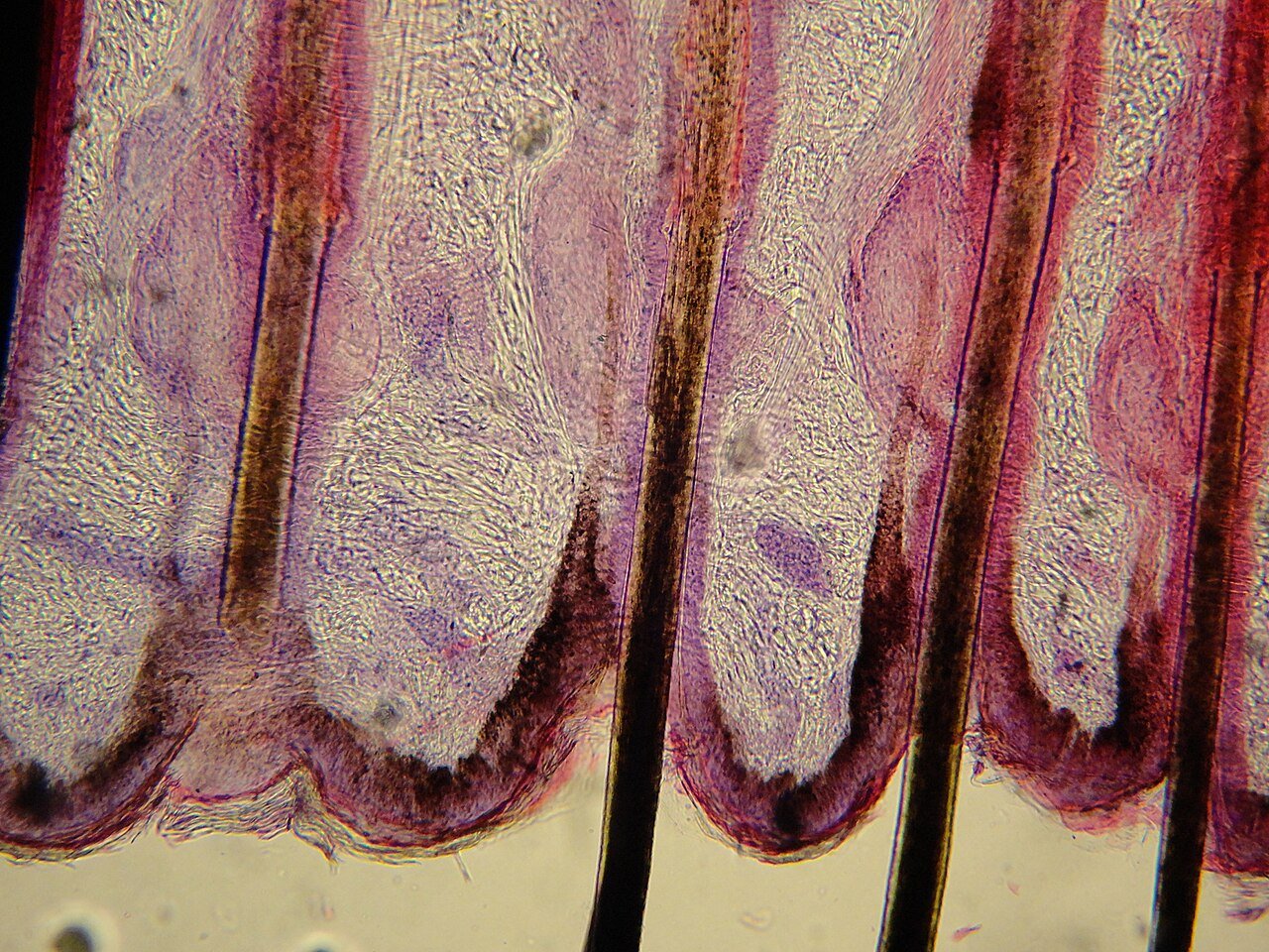 High-resolution photographic scalp mapping showing follicular recruitment and spatial regrowth density.