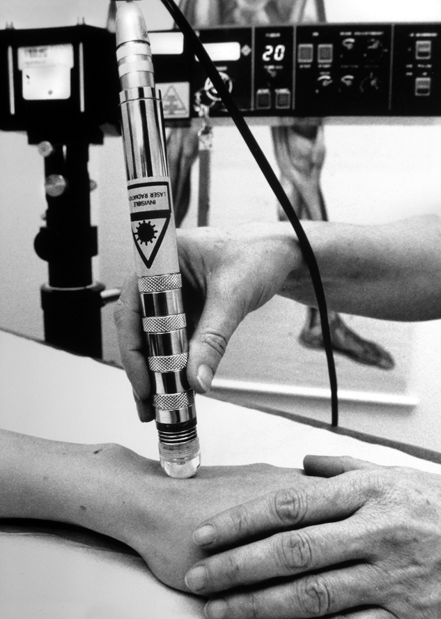 Medicinsk Laser för behandling av reumatism på en klinik i Malmö 1988.