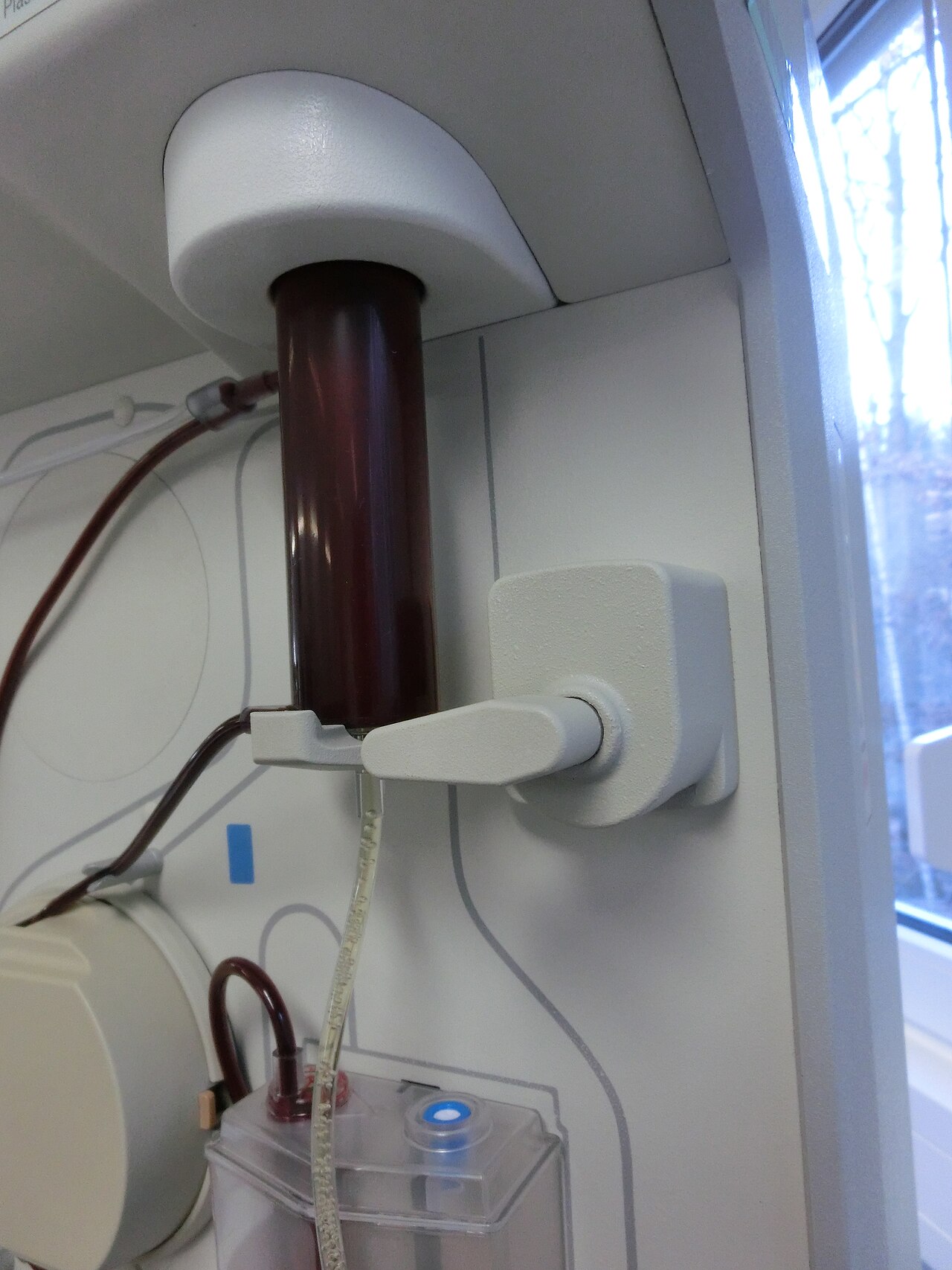 PRP (Platelet Rich Plasma) being injected into a hand