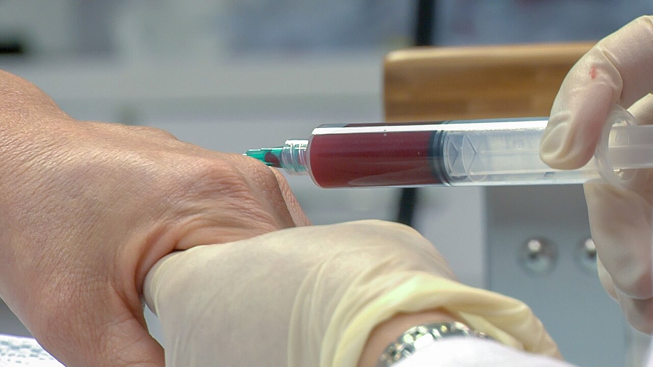 PRP (Platelet Rich Plasma) being injected into a hand