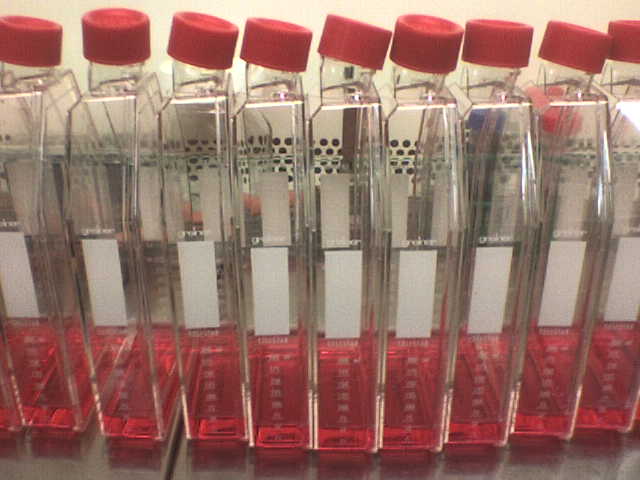 Stem Cell Conditioned Medium: The Quiet Treatment That's Building a Real Evidence Base