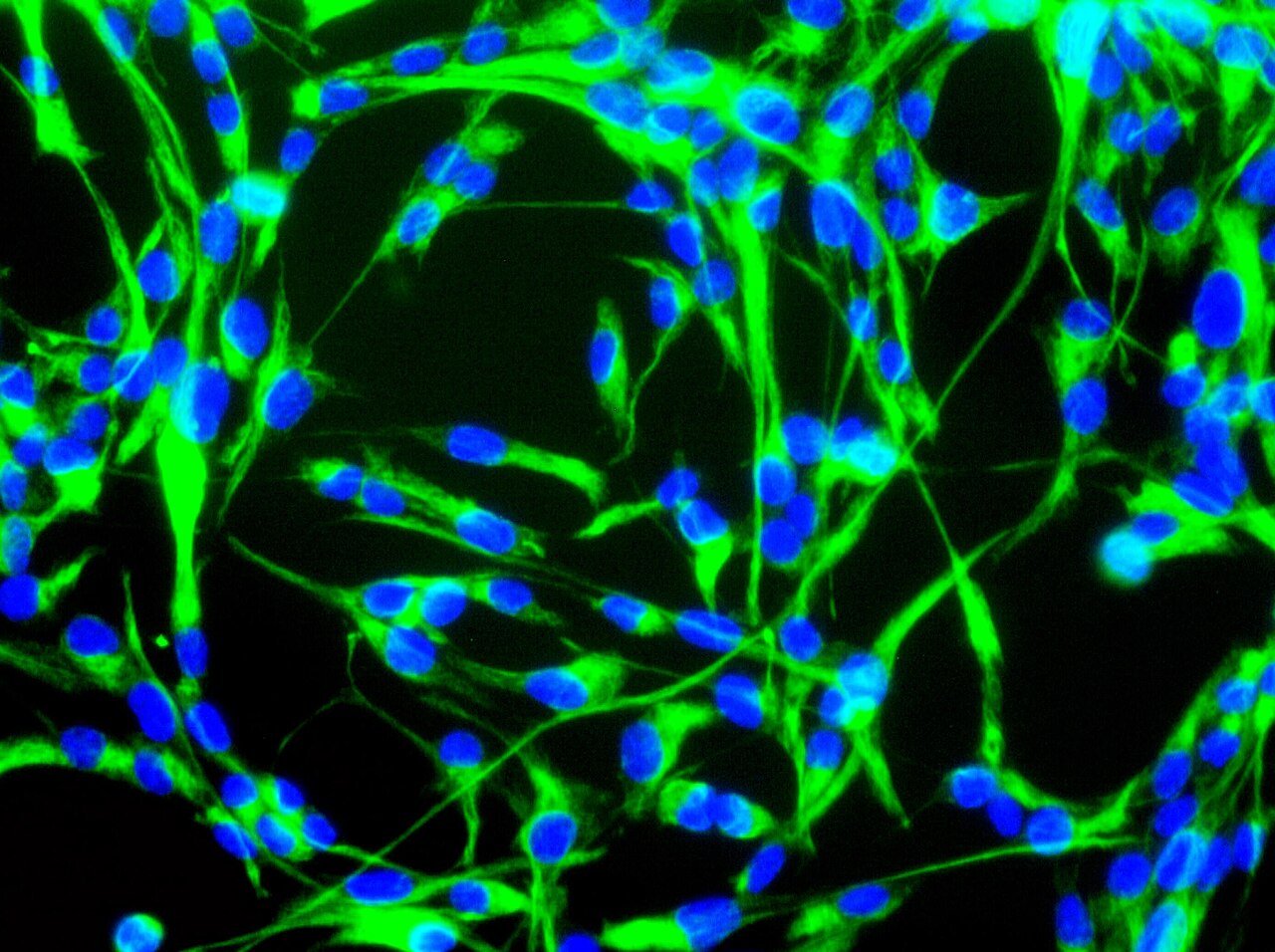 High-resolution photographic scalp mapping showing follicular recruitment and spatial regrowth density.