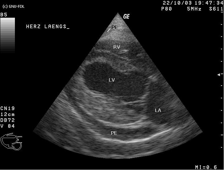 The Heart of the Matter: Unpacking the Cardiovascular Safety of Low-Dose Oral Minoxidil