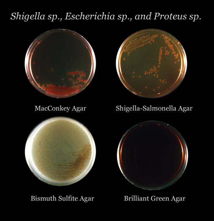The microbiome-hair connection: how gut bacteria drive follicle health