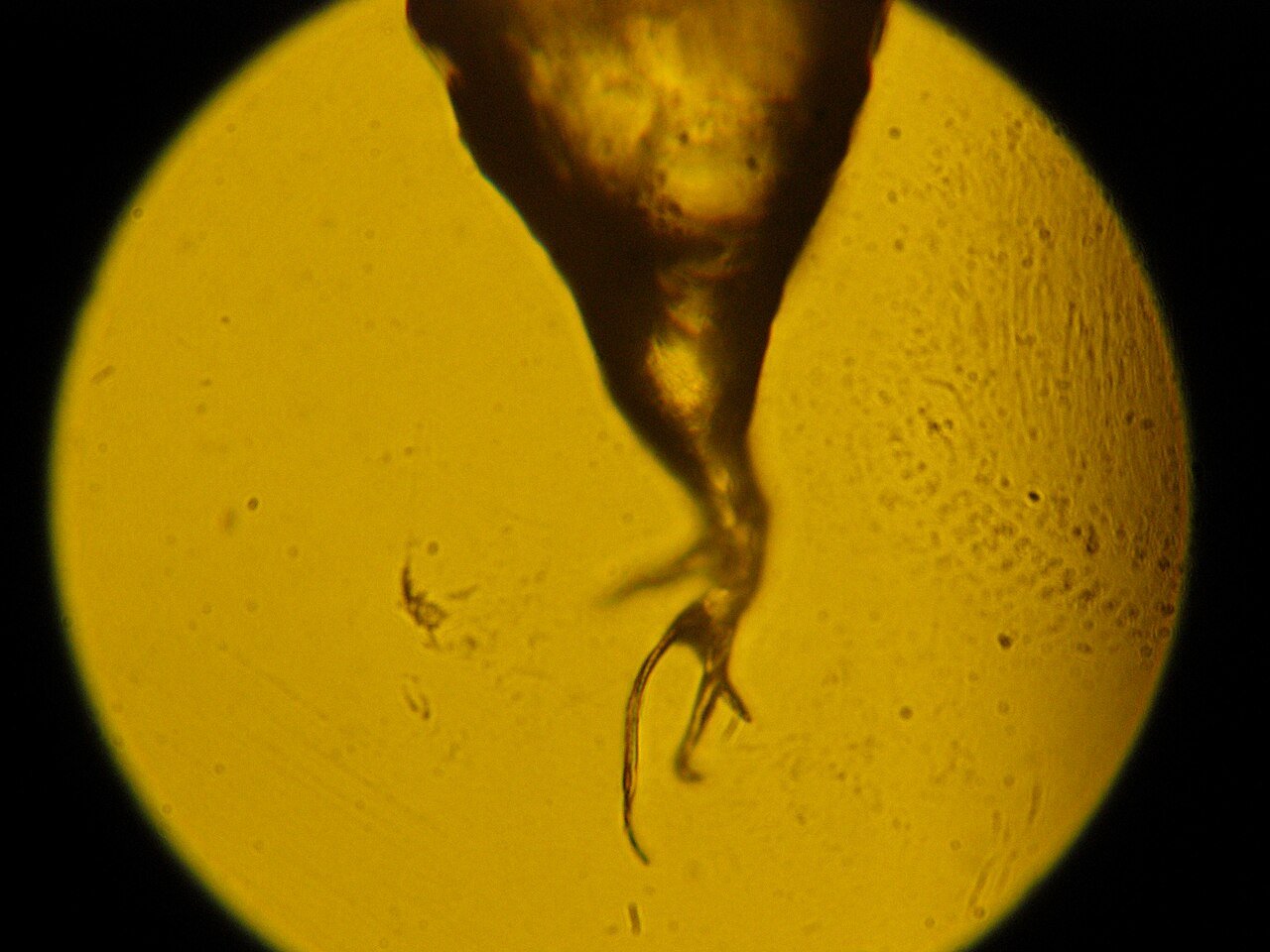 Dermatoscopic high-magnification trichoscopy comparing baseline follicular architecture to treated scalp.