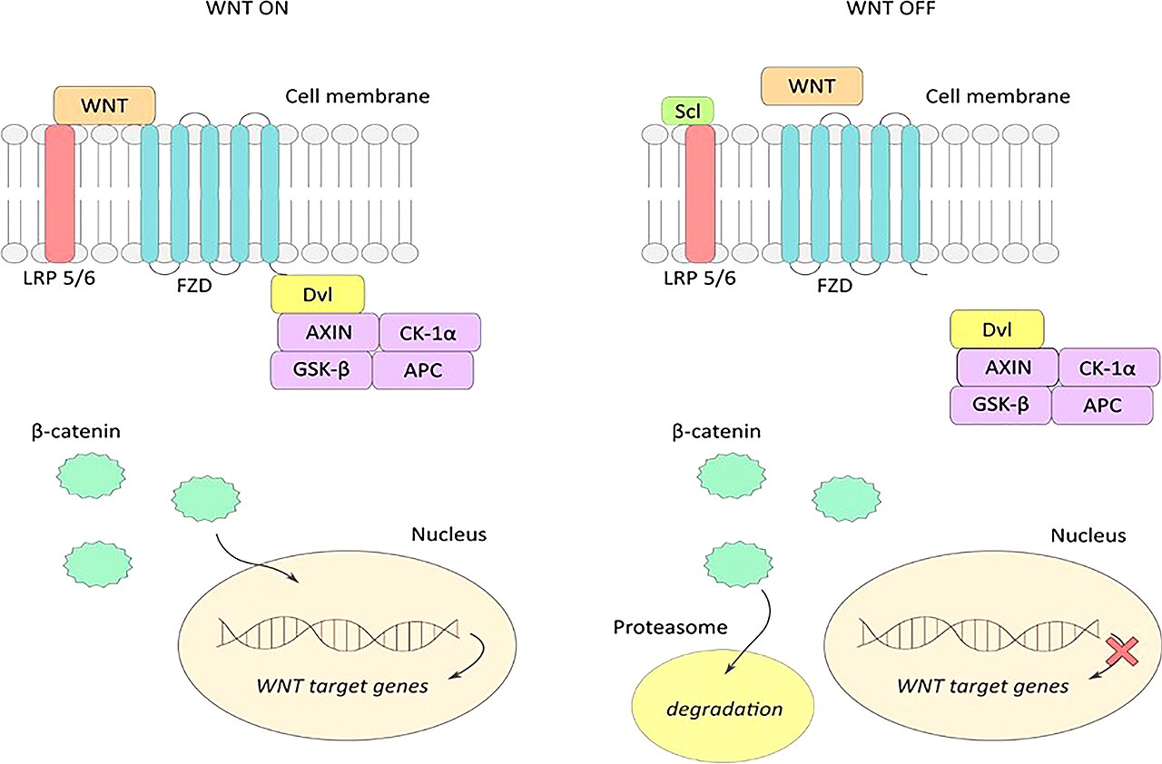 Figure 2 WNT ON-active signaling pathway: extracellular Wnt proteins bind to LRP5/6 and frizzled (FZD) receptors, and form an active Wnt-FZD-LRP5/6 receptor system leading to accumulation of the active form of β-catenin and its translocation to the cell nucleus. Attachment of β-c