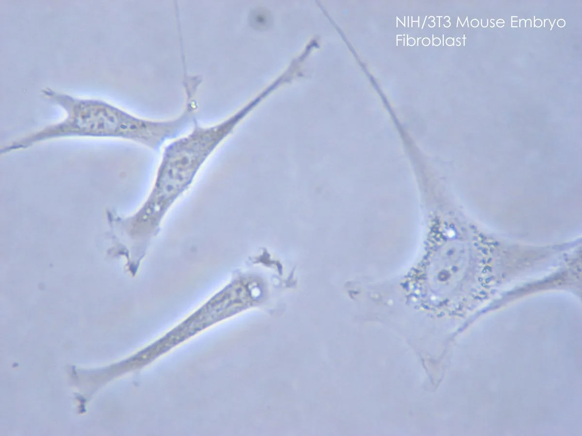 Fibroblasts drive scar formation; YAP/verteporfin inhibition redirects them toward regeneration.